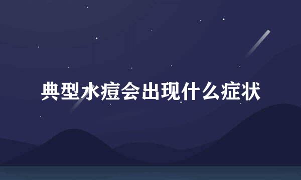 典型水痘会出现什么症状